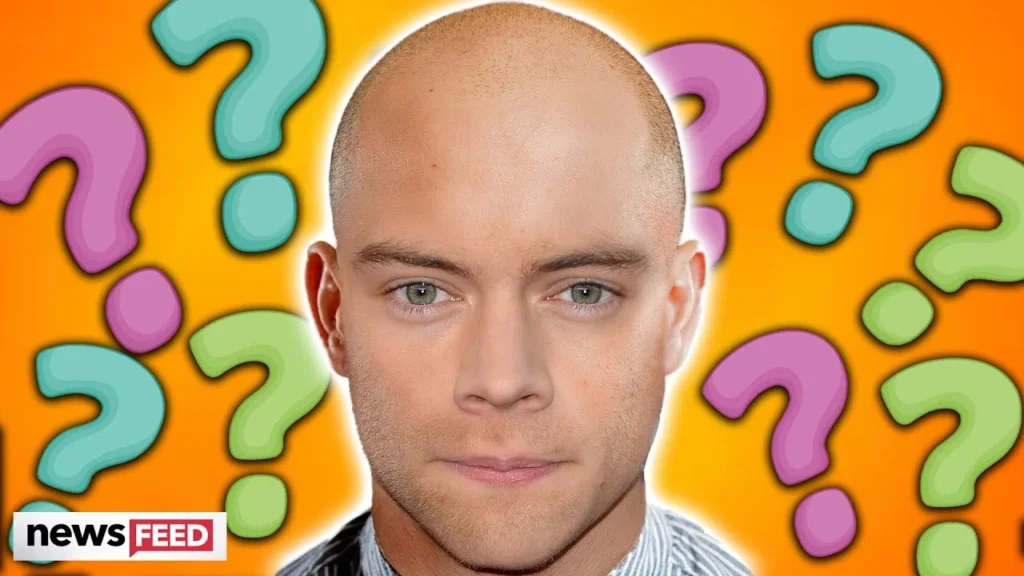 harry styles bald